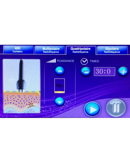 Cavitation + RadiofrÃƒÂ©quence 3D SMAR