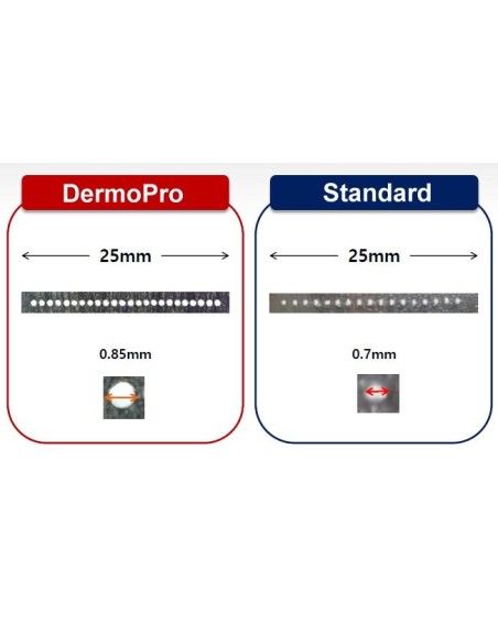 HIFU, l'Ultrason-Focalisé Dermopro
