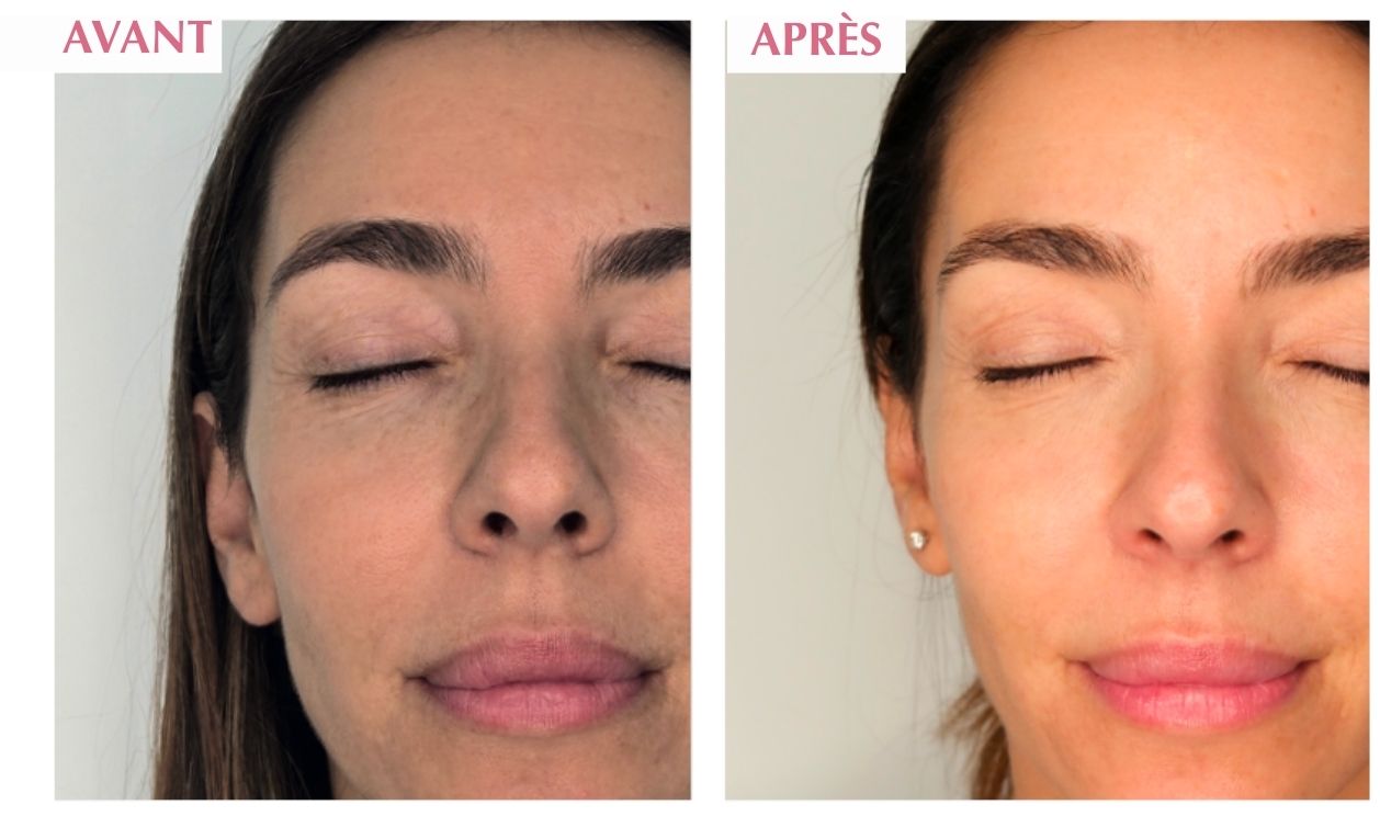 GOLDEN AGE AVANT APRES.jpg