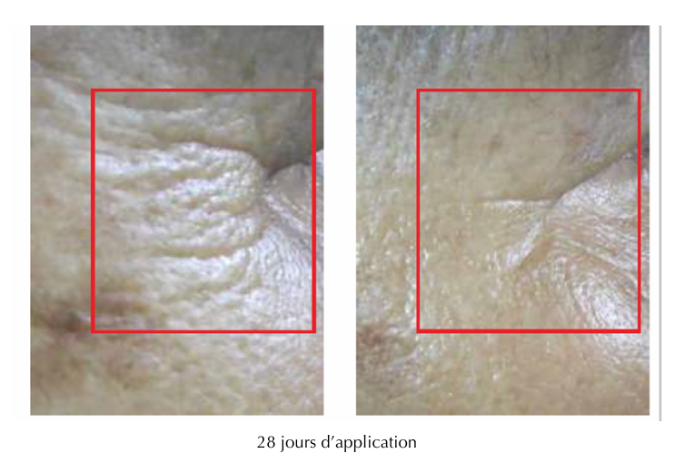 resultats golden age.png